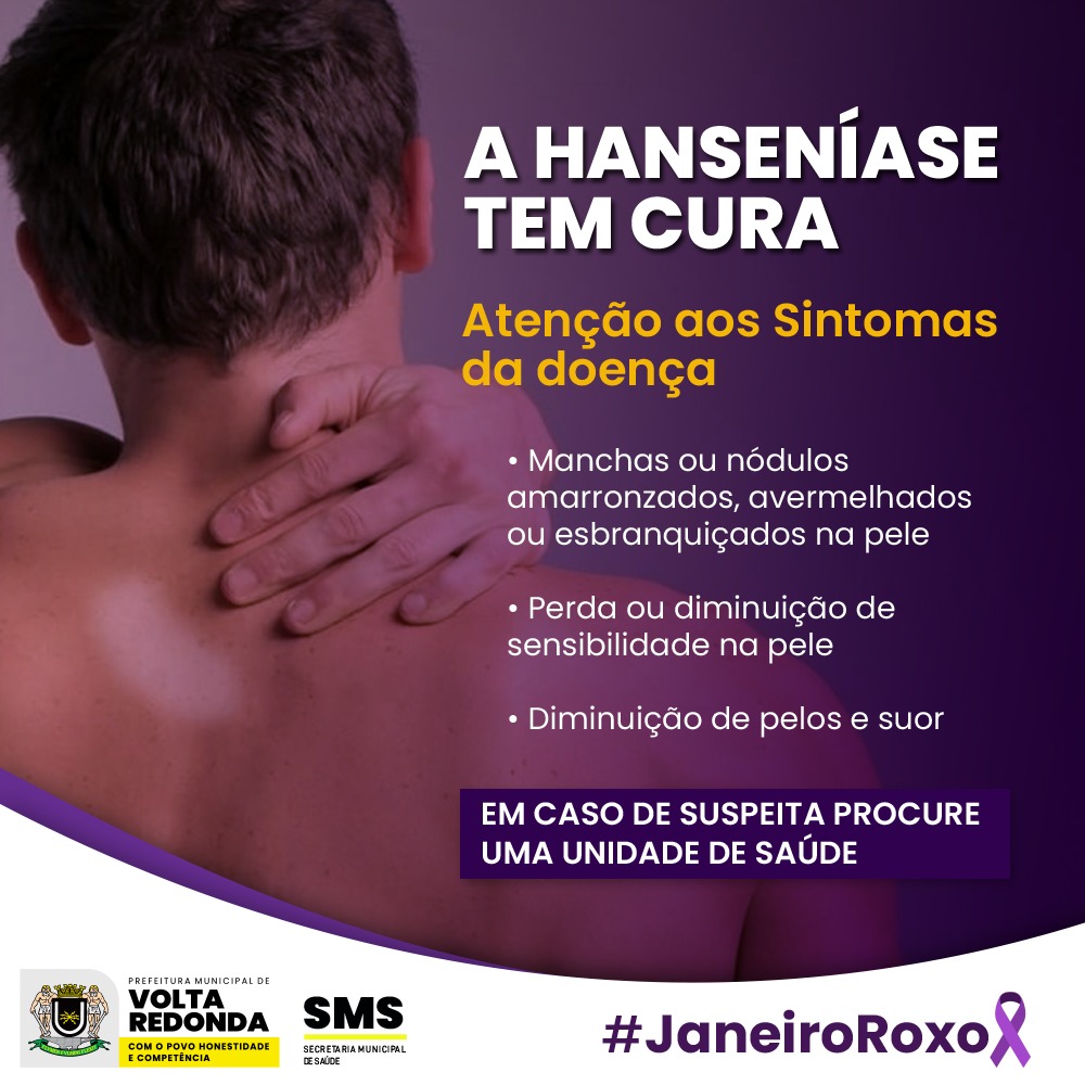 Prefeitura Municipal de Volta Redonda - JANEIRO ROXO: Volta Redonda promove  ações na campanha de controle e prevenção da hanseníase